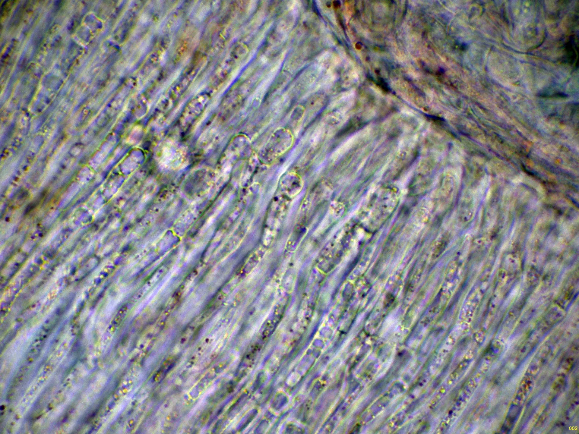 Microscopía de Pithya cupressina - 10 - Hifas marginales agua -002